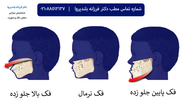 انواع فک و جراحی های آن