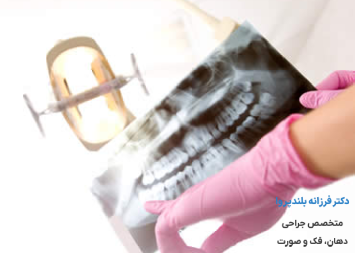 عکس رادیولوژی قبل از جراحی فک