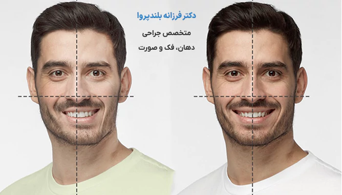 در چه سنی باید جراحی فک انجام داد؟