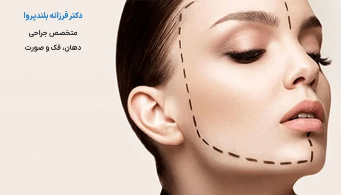 جراحی زاویه فک برای چه کسانی مناسب است؟