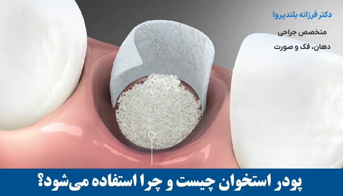 پودر استخوان چیست و چرا استفاده می‌شود؟